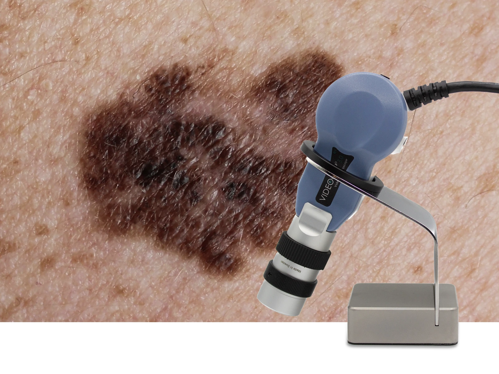 Prodotto Videocap Derma