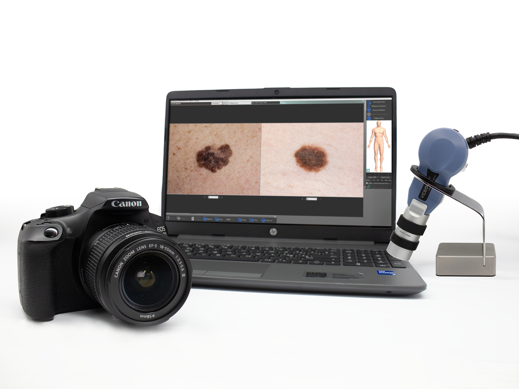 Kit Videocap Dermo Mapping